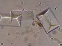 Imagen de microscopio CRISTALES DE ESTRUVITA en la orina de un gato